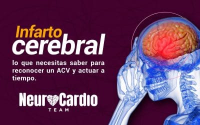 Lo que necesitas saber para reconocer un ACV y actuar a tiempo