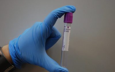 Manifestaciones Neurológicas de Hepatitis C: El Eje Sistémico