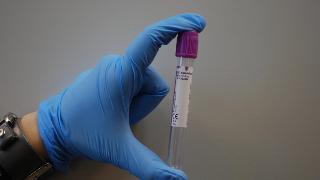 Profesional de laboratorio sosteniendo un tubo con muestra de sangre para análisis